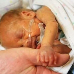 aiden-milner-baby-square COMPRESSED Cardinal Glennon patient Aiden Milner as a baby