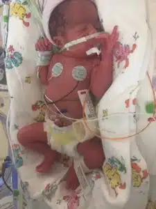 Cardinal Glennon patient Carlie