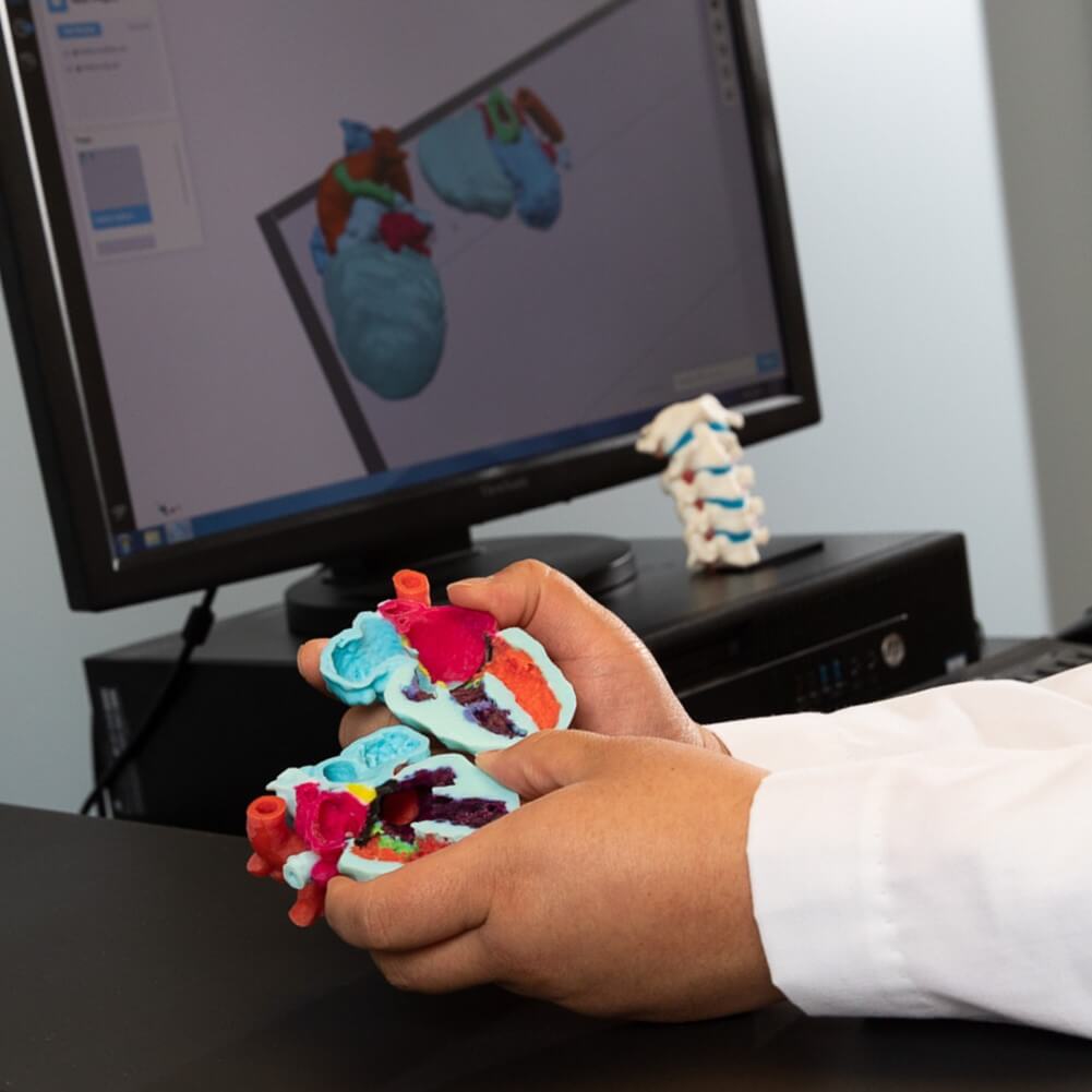 King-heart-square_160over90_CardGlennon_09201 Dr. King holding a 3D printed model of a patient's heart