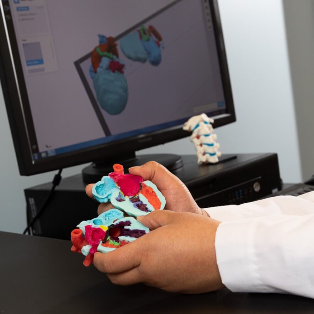 Dr. King holding a 3D printed model of a patient's heart