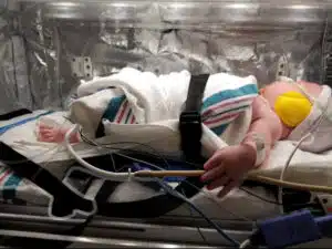 Kenzie - side view in transport isolette