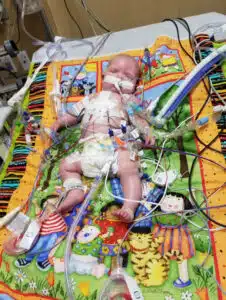 Kenzie - recovering in PICU bed