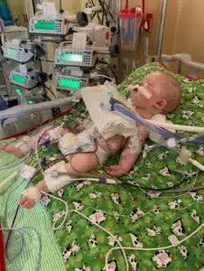 Kenzie - recovering in PICU bed at Cardinal Glennon