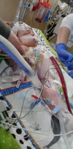 Easton - in PICU bed with nurses caring for him