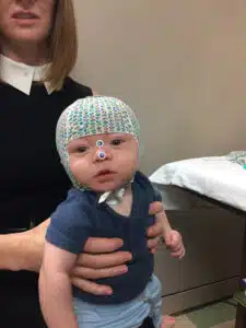 Colten as a toddler wearing a head cap before neurology testing