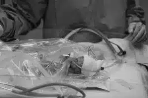 Colten - birth photo, receiving oxygen