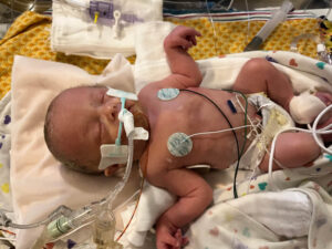 Josie in the NICU
