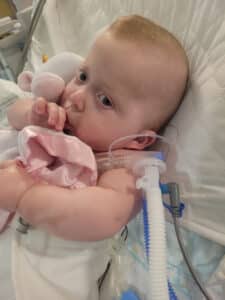 photo of a baby girl in a hospital bed with a trach tube