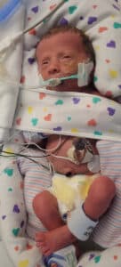 photo of a newborn baby in a NICU bed