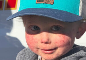 Brody wearing a ballcap